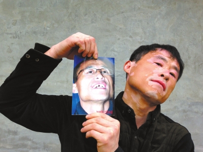 出狱后，贾相军第一时间拍了张照片，记录其门牙缺失的状态。京华时报记者李显峰摄